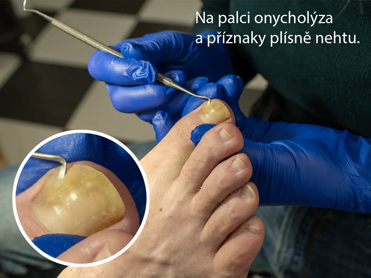 Podnikatel zkoumá nehet na noze během procedury péče o nohy.