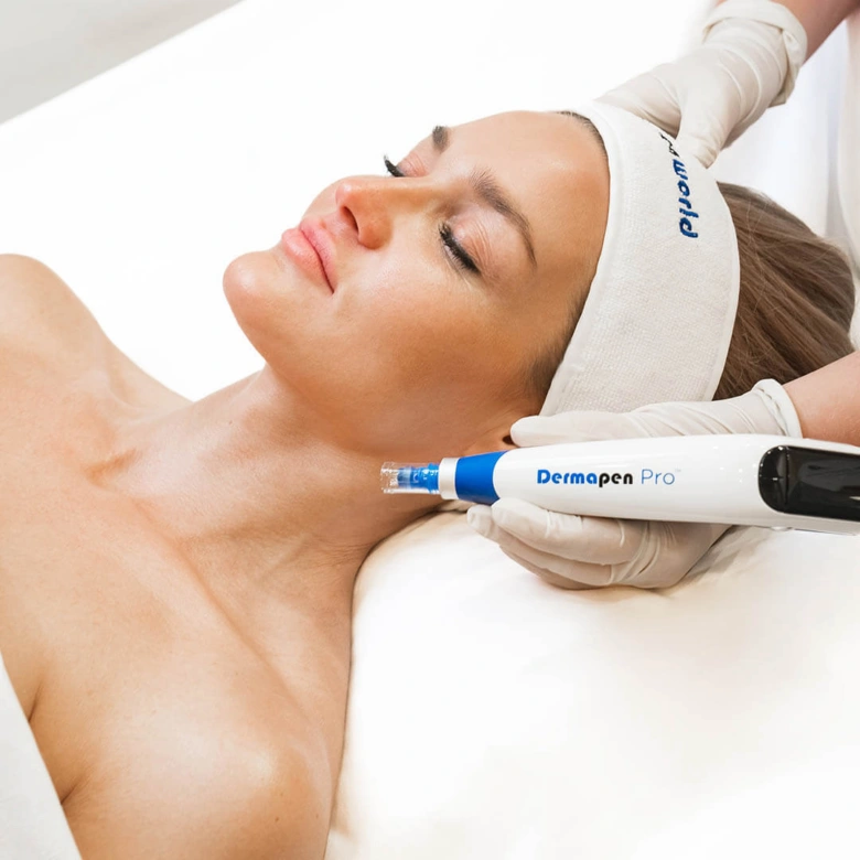 Žena podstupuje ošetření Dermapenu v pražském wellness centru.